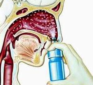 Điều trị bệnh viêm xoang