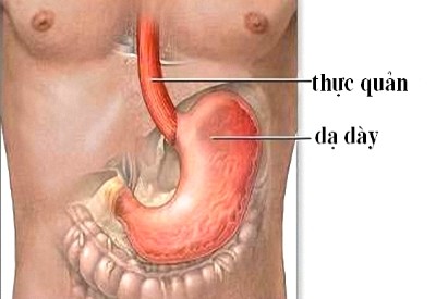 trào ngược dạ dày thực quản và bệnh viêm xoang mũi mãn tính