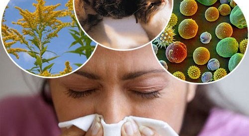 Bệnh viêm xoang gây khó chịu cho bệnh nhân