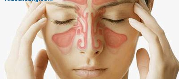 Điều trị viêm xoang mũi bằng Tây Y